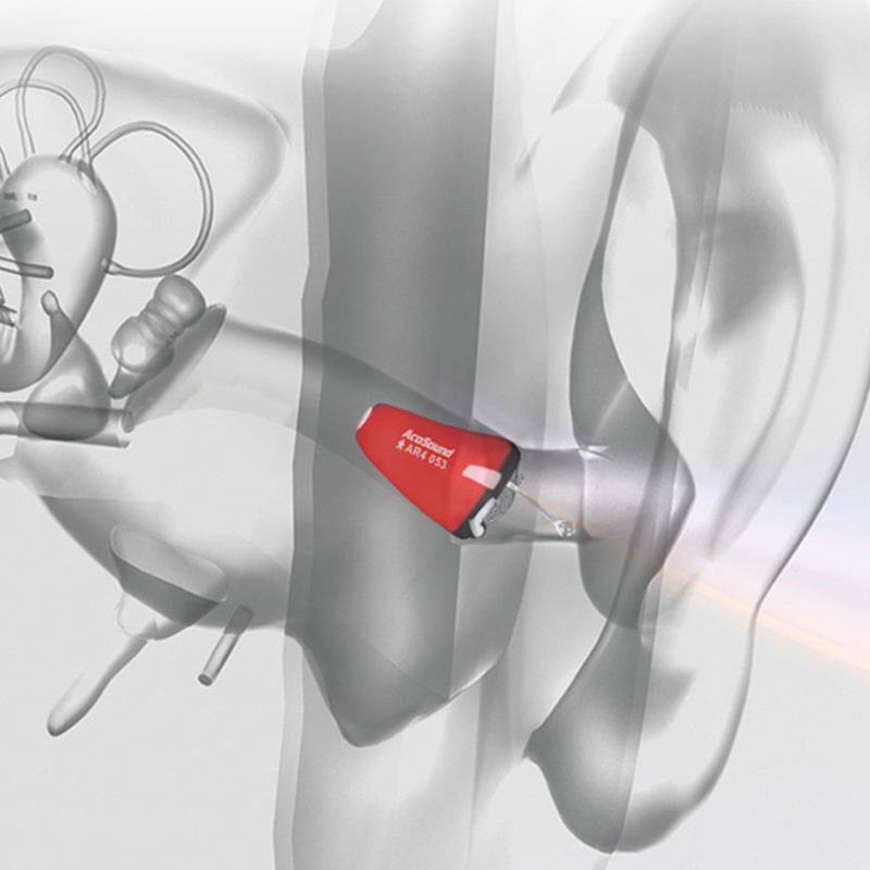 AcoSound Ruby Series Prothèses auditives IIC invisibles complètes numériques personnalisées